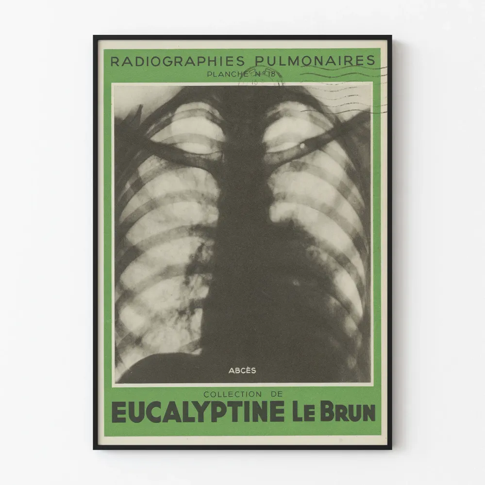 Ilmakuva keuhkokuva - paise - lääketieteellinen seinäkoriste vintage-tyylinen Poster